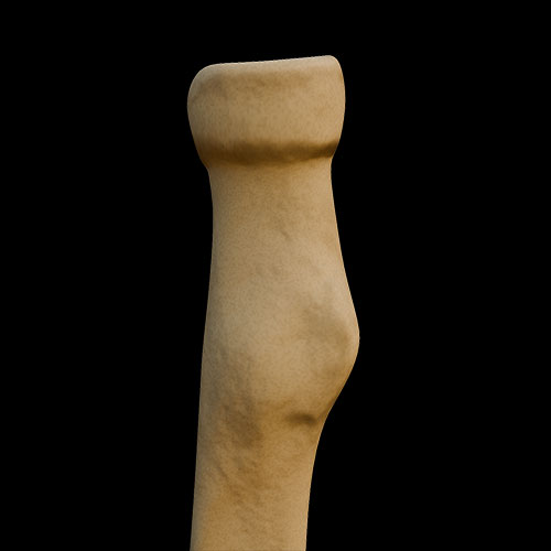 Radius