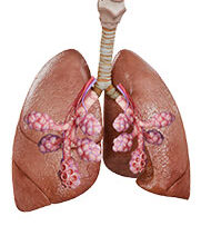 Physio-7-Respiratory
