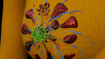 A UL 2 Mammary Gland – Thumbnail