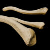A – UL – 4 – Clavicle – Thumbnail