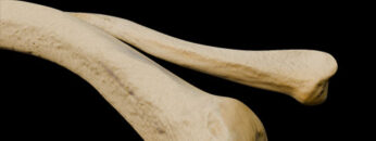A – UL – 4 – Clavicle – Thumbnail