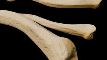 A – UL – 4 – Clavicle – Thumbnail