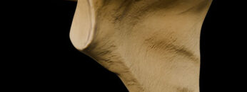 A UL 5 Scapula – Thumbnail