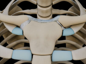 A UL 6 Clavicular joints – Thumbnail