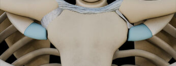 A UL 6 Clavicular joints – Thumbnail