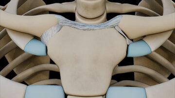 A UL 6 Clavicular joints – Thumbnail