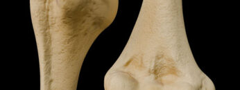 A UL 10 Humerus – Thumbnail