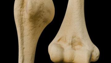 A UL 10 Humerus – Thumbnail