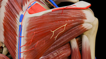 A UL 7 Scapular Region – Thumbnail