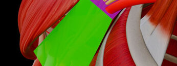 A UL 9 Axilla – Thumbnail