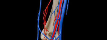 A UL 13 Arm Vessels – Thumbnail