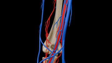 A UL 13 Arm Vessels – Thumbnail