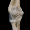 A UL 17 Elbow Joint – Thumbnail