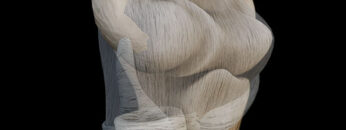 A UL 17 Elbow Joint – Thumbnail