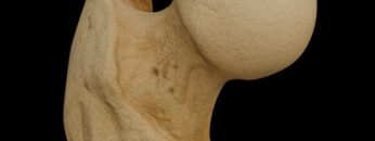 A LL 3 – Femur – Thumbnail