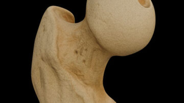 A LL 3 – Femur – Thumbnail