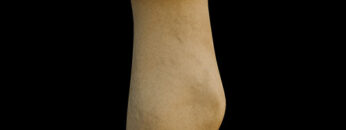 A UL 16 Radius – Thumbnail