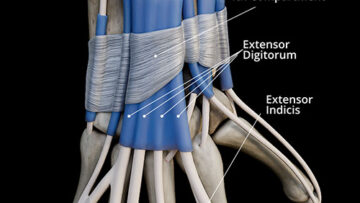 A UL 23 – Retinacula – Thumbnail