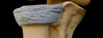 A UL 24 – Radioulnar Joints – Thumbnail