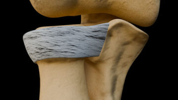 A UL 24 – Radioulnar Joints – Thumbnail