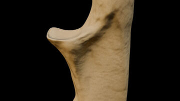 AUL 15 Ulna – Thumbnail