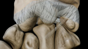 AUL 25 – Wrist Joint – Thumbnail