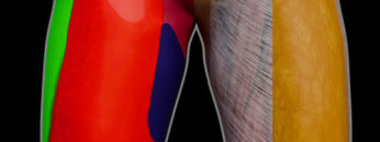 A LL 1 – Thigh – Surface Anatomy, Innervation & Fasciae – Thumbnail