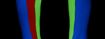 A UL 18 – Forearm – Surface Anatomy, General Layout – Thumbnail