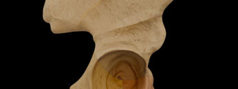 ALL 2 Hip Bone – Thumbnail