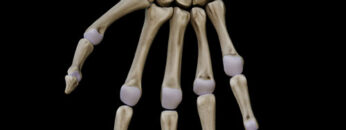 A UL 30 – Hand Bones – Thumbnail